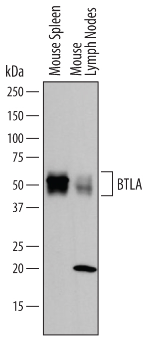 Western blot shows lysates of mouse spleen tissue and mouse lymph node tissue. PVDF membrane was probed with 1 µg/mL of Goat Anti-Mouse BTLA Antigen Affinity-purified Polyclonal Antibody (Catalog # AF3007) followed by HRP-conjugated Anti-Goat IgG Secondary Antibody (Catalog # HAF109). A specific band was detected for BTLA at approximately 60 kDa (as indicated). This experiment was conducted under reducing conditions and using Immunoblot Buffer Group 1.