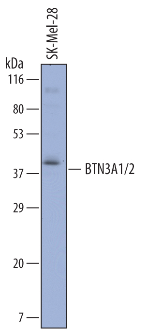 Western blot shows lysates of SK‑Mel‑28 human malignant melanoma cell line. PVDF membrane was probed with 1 µg/mL of Sheep Anti-Human BTN3A1/2 Antigen Affinity-purified Polyclonal Antibody (Catalog # AF7136) followed by HRP-conjugated Anti-Sheep IgG Secondary Antibody (Catalog # HAF016). A specific band was detected for BTN3A1/2 at approximately 40 kDa (as indicated). This experiment was conducted under reducing conditions and using Immunoblot Buffer Group 8.