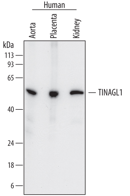 Western blot shows lysates of human aorta tissue, human placenta tissue, and human kidney tissue. PVDF membrane was probed with 0.25 µg/mL of Sheep Anti-Human TINAGL1 Antigen Affinity-purified Polyclonal Antibody (Catalog # AF7185) followed by HRP-conjugated Anti-Sheep IgG Secondary Antibody (Catalog # HAF016). A specific band was detected for TINAGL1 at approximately 55 kDa (as indicated). This experiment was conducted under reducing conditions and using Immunoblot Buffer Group 1.