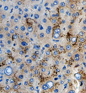 Protein O‑Glucosyltransferase 1/POGLUT was detected in immersion fixed paraffin-embedded sections of human liver using Mouse Anti-Human Protein O‑Glucosyltransferase 1/POGLUT Monoclonal Antibody (Catalog # MAB64371) at 15 µg/mL overnight at 4 °C. Before incubation with the primary antibody, tissue was subjected to heat-induced epitope retrieval using Antigen Retrieval Reagent-Basic (Catalog # CTS013). Tissue was stained using the Anti-Mouse HRP-DAB Cell & Tissue Staining Kit (brown; Catalog # CTS002) and counterstained with hematoxylin (blue). Specific staining was localized to the cytoplasm of hepatocytes. View our protocol for Chromogenic IHC Staining of Paraffin-embedded Tissue Sections.