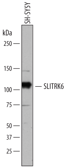 Western blot shows lysates of SH‑SY5Y human neuroblastoma cell line. PVDF membrane was probed with 2 µg/mL of Sheep Anti-Human SLITRK6 Antigen Affinity-purified Polyclonal Antibody (Catalog # AF7317) followed by HRP-conjugated Anti-Sheep IgG Secondary Antibody (Catalog # HAF016). A specific band was detected for SLITRK6 at approximately 100 kDa (as indicated). This experiment was conducted under reducing conditions and using Immunoblot Buffer Group 1.
