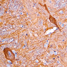 Dimethylarginine Dimethylaminohydrolase 1/DDAH1 was detected in immersion fixed paraffin-embedded sections of human brain using Sheep Anti-Human Dimethylarginine Dimethylaminohydrolase 1/DDAH1 Antigen Affinity-purified Polyclonal Antibody (Catalog # AF6530) at 3 µg/mL overnight at 4 °C. Before incubation with the primary antibody, tissue was subjected to heat-induced epitope retrieval using Antigen Retrieval Reagent-Basic (Catalog # CTS013). Tissue was stained using the Anti-Sheep HRP-DAB Cell & Tissue Staining Kit (brown; Catalog # CTS019) and counterstained with hematoxylin (blue). Specific staining was localized to neuronal cell bodies and processes. View our protocol for Chromogenic IHC Staining of Paraffin-embedded Tissue Sections.