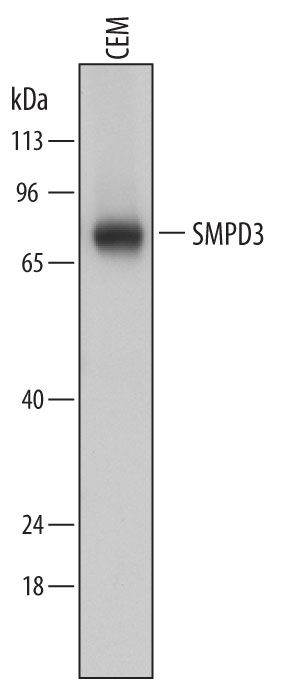Western blot shows lysates of CEM human T-lymphoblastoid cell line. PVDF membrane was probed with 1 µg/mL of Mouse Anti-Human SMPD3 Monoclonal Antibody (Catalog # MAB7184) followed by HRP-conjugated Anti-Mouse IgG Secondary Antibody (Catalog # HAF018). A specific band was detected for SMPD3 at approximately 70-75 kDa (as indicated). This experiment was conducted under reducing conditions and using Immunoblot Buffer Group 1.