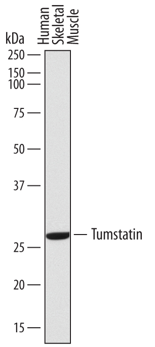Western blot shows lysates of human skeletal muscle tissue. PVDF membrane was probed with 2 µg/mL of Mouse Anti-Human Tumstatin Monoclonal Antibody (Catalog # MAB7546) followed by HRP-conjugated Anti-Mouse IgG Secondary Antibody (Catalog # HAF007). A specific band was detected for Tumstatin at approximately 26 kDa (as indicated). This experiment was conducted under reducing conditions and using Immunoblot Buffer Group 8.