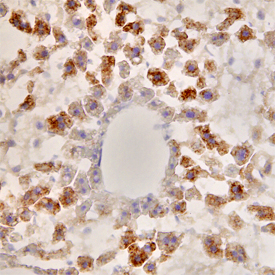 Serum Amyloid A4 was detected in perfusion fixed frozen sections of mouse brain (cerebellum) using Mouse Serum Amyloid A4 Monoclonal Antibody (Catalog # MAB4276) at 25 µg/mL overnight at 4 °C. Tissue was stained using the Anti-Rat HRP-DAB Cell & Tissue Staining Kit (brown; Catalog # CTS017) and counterstained with hematoxylin (blue). View our protocol for Chromogenic IHC Staining of Frozen Tissue Sections.