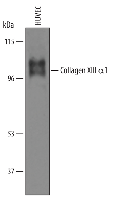 Western blot shows lysates of HUVEC human umbilical vein endothelial cells. PVDF Membrane was probed with 1 µg/mL of Human Collagen XIII  alpha 1 Antigen Affinity-purified Polyclonal Antibody (Catalog # AF6346) followed by HRP-conjugated Anti-Sheep IgG Secondary Antibody (Catalog # HAF016). Two specific bands were detected for Collagen XIII a1 at approximately 100 and 110 kDa (as indicated). This experiment was conducted under reducing conditions and using Immunoblot Buffer Group 8.