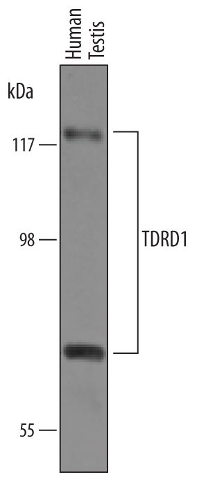 Western blot shows lysates of human testis tissue. PVDF membrane was probed with 1 µg/mL of Sheep Anti-Human TDRD1 Antigen Affinity-purified Polyclonal Antibody (Catalog # AF6296) followed by HRP-conjugated Anti-Sheep IgG Secondary Antibody (Catalog # HAF016). Specific bands were detected for TDRD1 at approximately 75 and 120 kDa (as indicated). This experiment was conducted under reducing conditions and using Immunoblot Buffer Group 8.