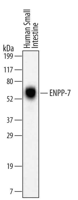 Western blot shows lysates of human small intestine tissue. PVDF Membrane was probed with 2 µg/mL of Mouse Anti-Human ENPP‑7/Alk‑SMase Monoclonal Antibody (Catalog # MAB4924) followed by HRP-conjugated Anti-Mouse IgG Secondary Antibody (Catalog # HAF007). A specific band was detected for ENPP‑7/Alk‑SMase at approximately 60 kDa (as indicated). This experiment was conducted under reducing conditions and using Immunoblot Buffer Group 1.