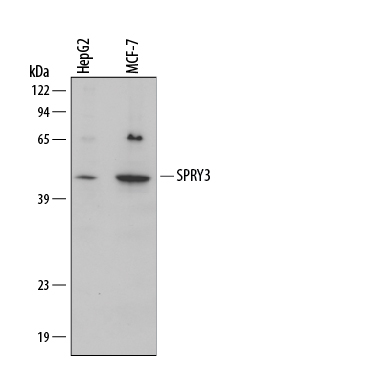 Western blot shows lysates of HepG2 human hepatocellular carcinoma cell line and MCF‑7 human breast cancer cell line. PVDF membrane was probed with 1 µg/mL of Human SPRY3 Antigen Affinity-purified Polyclonal Antibody (Catalog # AF5735) followed by HRP-conjugated Anti‑Sheep IgG Secondary Antibody (Catalog # HAF016). A specific band was detected for SPRY3 at approximately 42 kDa (as indicated). This experiment was conducted under reducing conditions and using Immunoblot Buffer Group 1.