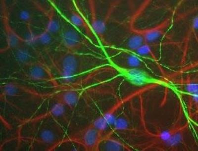 Immunocytochemistry/Immunofluorescence: NF-H Antibody [NBP1-05215] - Shows mixed neuron/glial rat brain cultures stained with NBP1-05215 (green) and chicken polyclonal antibody to Glial Fibrillary Acidic Protein (GFAP) NBP1-05198 (red). The neurofilament NF-H antibody binds to phosphorylated axonal forms of NF-H and non-phosphorylated dendritic and perikaryal forms.