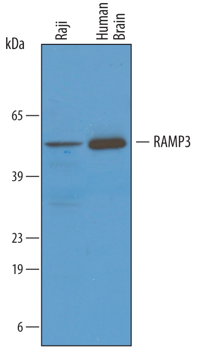 Western blot shows lysates of Raji human Burkitt's lymphoma cell line and human brain tissue. PVDF membrane was probed with 1 µg/mL of Sheep Anti-Human RAMP3 Antigen Affinity-purified Polyclonal Antibody (Catalog # AF4875) followed by HRP-conjugated Anti-Sheep IgG Secondary Antibody (Catalog # HAF016). A specific band was detected for RAMP3 at approximately 50 kDa (as indicated). This experiment was conducted under reducing conditions and using Immunoblot Buffer Group 8.