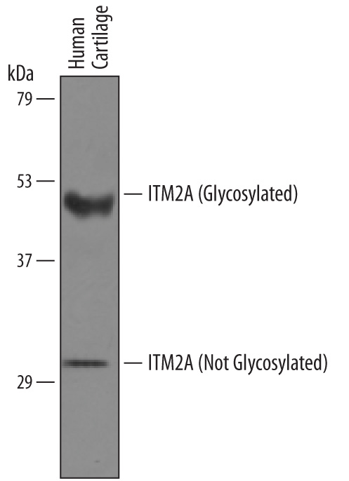Western blot shows lysates of human cartilage tissue. PVDF membrane was probed with 1 µg/mL of Sheep Anti-Human ITM2A Antigen Affinity-purified Polyclonal Antibody (Catalog # AF4876) followed by HRP-conjugated Anti-Sheep IgG Secondary Antibody (Catalog # HAF016). Specific bands were detected for ITM2A (glycosylated) at approximately 45 kDa and ITM2A (not glycosylated) at approximately 30 kDa (as indicated). This experiment was conducted under reducing conditions and using Immunoblot Buffer Group 8.