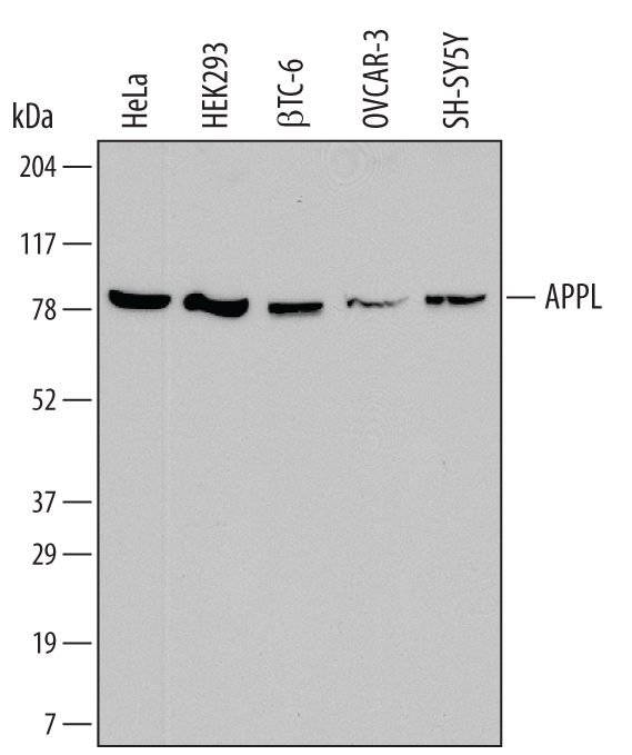Western blot shows lysates of HeLa human cervical epithelial carcinoma cell line, HEK293 human embryonic kidney cell line,  beta TC‑6 mouse beta cell insulinoma cell line, OVCAR‑3 human ovarian carcinoma cell line, and SH‑SY5Y human neuroblastoma cell line. PVDF membrane was probed with 1 µg/mL of Mouse Anti-Human APPL Monoclonal Antibody (Catalog # MAB7075) followed by HRP-conjugated Anti-Mouse IgG Secondary Antibody (Catalog # HAF007). A specific band was detected for APPL at approximately 80 kDa (as indicated). This experiment was conducted under reducing conditions and using Immunoblot Buffer Group 1.