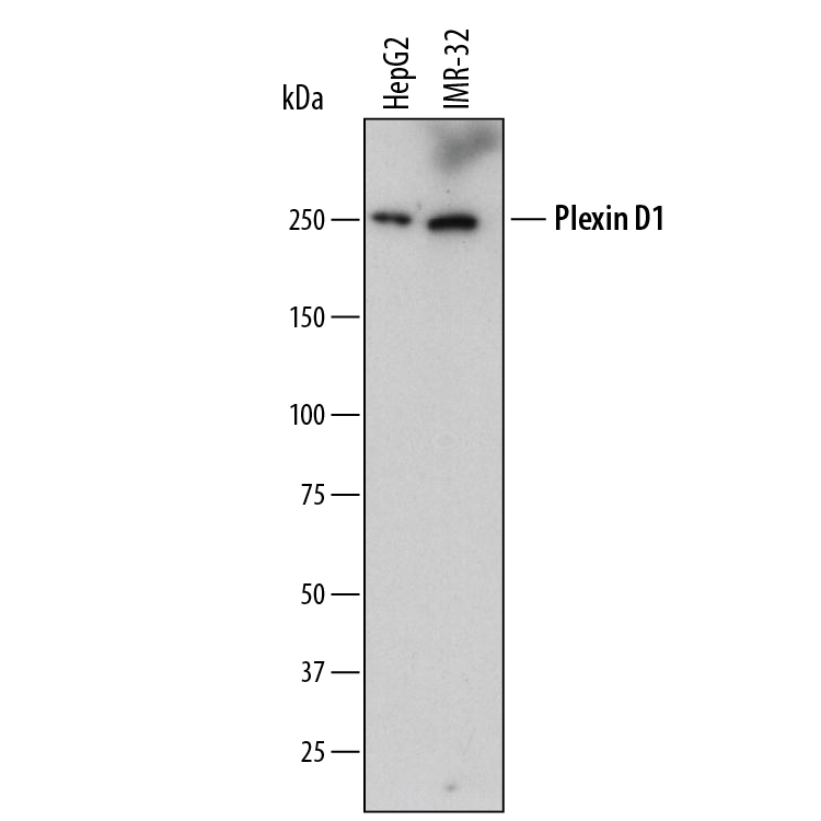 Western blot shows lysates of HepG2 human hepatocellular carcinoma cell line and IMR‑32 human neuroblastoma cell line. PVDF membrane was probed with 2 µg/mL of Mouse Anti-Human Plexin D1 Monoclonal Antibody (Catalog # MAB41601) followed by HRP-conjugated Anti-Mouse IgG Secondary Antibody (Catalog # HAF007). A specific band was detected for Plexin D1 at approximately 250 kDa (as indicated). This experiment was conducted under reducing conditions and using Immunoblot Buffer Group 1.