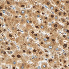 MTF2 was detected in immersion fixed paraffin-embedded sections of human liver using Sheep Anti-Human MTF2 Antigen Affinity-purified Polyclonal Antibody (Catalog # AF6846) at 3 µg/mL overnight at 4 °C. Before incubation with the primary antibody, tissue was subjected to heat-induced epitope retrieval using Antigen Retrieval Reagent-Basic (Catalog # CTS013). Tissue was stained using the Anti-Sheep HRP-DAB Cell & Tissue Staining Kit (brown; Catalog # CTS019) and counterstained with hematoxylin (blue). Specific staining was localized to nuclei in hepatocytes. View our protocol for Chromogenic IHC Staining of Paraffin-embedded Tissue Sections.