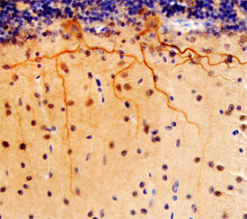 NGL‑3/LRRC4B was detected in immersion fixed paraffin-embedded sections of human brain (cerebellum) using Mouse Anti-Human NGL‑3/LRRC4B Monoclonal Antibody (Catalog # MAB6919) at 15 µg/mL overnight at 4 °C. Before incubation with the primary antibody, tissue was subjected to heat-induced epitope retrieval using Antigen Retrieval Reagent-Basic (Catalog # CTS013). Tissue was stained using the Anti-Mouse HRP-DAB Cell & Tissue Staining Kit (brown; Catalog # CTS002) and counterstained with hematoxylin (blue). Specific staining was localized to the cytoplasm of Purkinje cells. View our protocol for Chromogenic IHC Staining of Paraffin-embedded Tissue Sections.