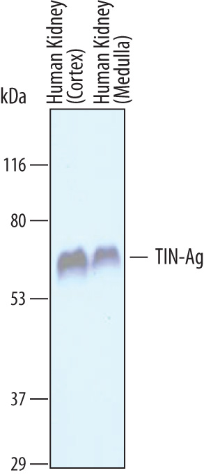 Western blot shows lysates of human kidney (cortex and medulla) tissue. PVDF Membrane was probed with 1 µg/mL of Sheep Anti-Human TIN-Ag Antigen Affinity-purified Polyclonal Antibody (Catalog # AF6797) followed by HRP-conjugated Anti-Sheep IgG Secondary Antibody (Catalog # HAF016). A specific band was detected for TIN-Ag at approximately 55-60 kDa (as indicated). This experiment was conducted under reducing conditions and using Immunoblot Buffer Group 1.