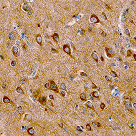 SALM2 was detected in immersion fixed paraffin-embedded sections of human cerebellum using Human SALM2/LRFN1 Monoclonal Antibody (Catalog # MAB5669) at 15 µg/mL overnight at 4 °C. Before incubation with the primary antibody, tissue was subjected to heat-induced epitope retrieval using Antigen Retrieval Reagent-Basic (Catalog # CTS013). Tissue was stained using the Anti-Mouse HRP-DAB Cell & Tissue Staining Kit (brown; Catalog # CTS002) and counterstained with hematoxylin (blue). View our protocol for Chromogenic IHC Staining of Paraffin-embedded Tissue Sections.