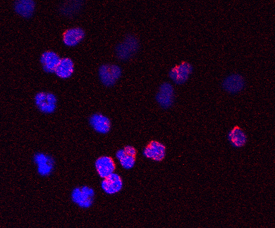 FOLR2 was detected in immersion fixed human neutrophils using Mouse Anti-Human FOLR2 Monoclonal Antibody (Catalog # MAB5697) at 10 µg/mL for 3 hours at room temperature. Cells were stained using the NorthernLights™ 557-conjugated Anti-Mouse IgG Secondary Antibody (red; Catalog # NL007) and counterstained with DAPI (blue). Specific staining was localized to cell surfaces and cytoplasm. View our protocol for Fluorescent ICC Staining of Non-adherent Cells.