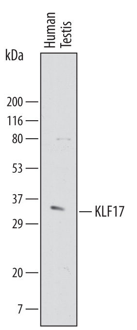 Western blot shows lysates of human testis tissue. PVDF membrane was probed with 1 µg/mL of Sheep Anti-Human KLF17 Antigen Affinity-purified Polyclonal Antibody (Catalog # AF6845) followed by HRP-conjugated Anti-Sheep IgG Secondary Antibody (Catalog # HAF016). A specific band was detected for KLF17 at approximately 37 kDa (as indicated). This experiment was conducted under reducing conditions and using Immunoblot Buffer Group 8.