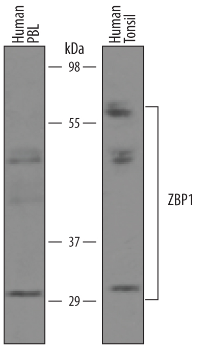 Western blot shows lysates of human peripheral blood lymphocytes (PBL) and human tonsil tissue. PVDF membrane was probed with 1 µg/mL of Sheep Anti-Human ZBP1/DLM‑1/DAI Antigen Affinity-purified Polyclonal Antibody (Catalog # AF6309) followed by HRP-conjugated Anti-Sheep IgG Secondary Antibody (Catalog # HAF016). Specific bands were detected for ZBP1/DLM‑1/DAI at approximately 30-60 kDa (as indicated). This experiment was conducted under reducing conditions and using Immunoblot Buffer Group 1.