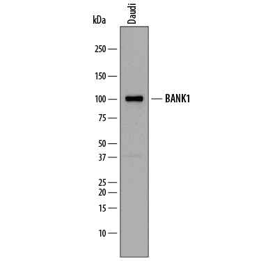 Western blot shows lysates of Daudi human Burkitt's lymphoma cell line. PVDF membrane was probed with 1 µg/mL of Sheep Anti-Human BANK1 Antigen Affinity-purified Polyclonal Antibody (Catalog # AF8005) followed by HRP-conjugated Anti-Sheep IgG Secondary Antibody (Catalog # HAF016). A specific band was detected for BANK1 at approximately 100 kDa (as indicated). This experiment was conducted under reducing conditions and using Immunoblot Buffer Group 1.