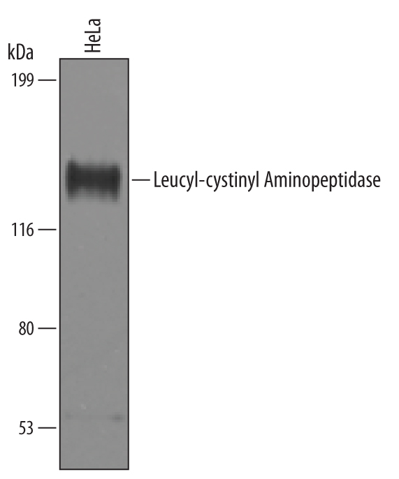 Western blot shows lysates of HeLa human cervical epithelial carcinoma cell line. PVDF Membrane was probed with 1 µg/mL of Human Leucyl-cystinyl Aminopeptidase/LNPEP Antigen Affinity-purified Polyclonal Antibody (Catalog # AF6386) followed by HRP-conjugated Anti-Sheep IgG Secondary Antibody (Catalog # HAF016). A specific band was detected for Leucyl-cystinyl Aminopeptidase/LNPEP at approximately 170 kDa (as indicated). This experiment was conducted under reducing conditions and using Immunoblot Buffer Group 8.