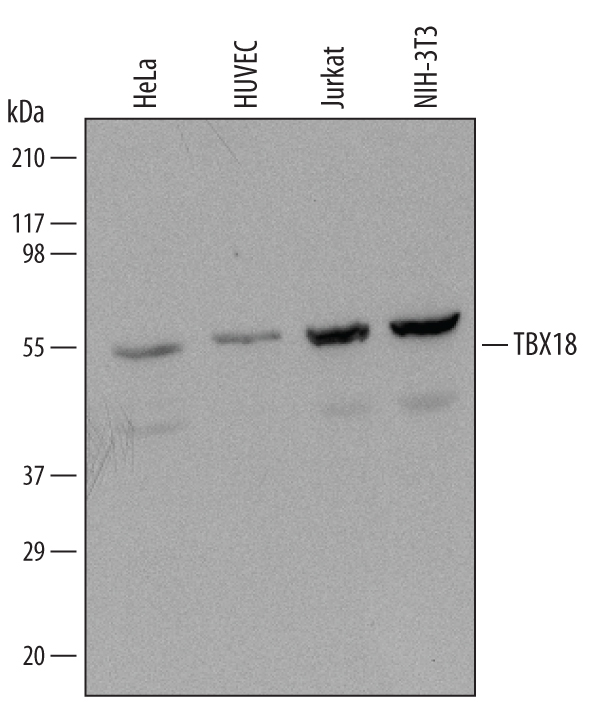 Western blot shows lysates of HeLa human cervical epithelial carcinoma cell line, HUVEC human umbilical vein endothelial cells, Jurkat human acute T cell leukemia cell line, and NIH‑3T3 mouse embryonic fibroblast cell line. PVDF Membrane was probed with 0.5 µg/mL of Mouse Anti-Human TBX18 Monoclonal Antibody (Catalog # MAB6337) followed by HRP-conjugated Anti-Mouse IgG Secondary Antibody (Catalog # HAF007). A specific band was detected for TBX18 at approximately 65 kDa (as indicated). This experiment was conducted under reducing conditions and using Immunoblot Buffer Group 1.