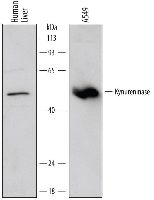 Western blot shows lysates of human liver tissue and A549 human lung carcinoma cell line. PVDF membrane was probed with 2 µg/mL of Mouse Anti-Human Kynureninase Monoclonal Antibody (Catalog # MAB4887) followed by HRP-conjugated Anti-Mouse IgG Secondary Antibody (Catalog # HAF007). A specific band was detected for Kynureninase at approximately 52 kDa (as indicated). This experiment was conducted under reducing conditions and using Immunoblot Buffer Group 1.