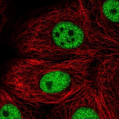 Immunocytochemistry/Immunofluorescence: TBX2 Antibody [NBP1-89459] - Staining of human cell line MCF7 shows localization to nucleoplasm.