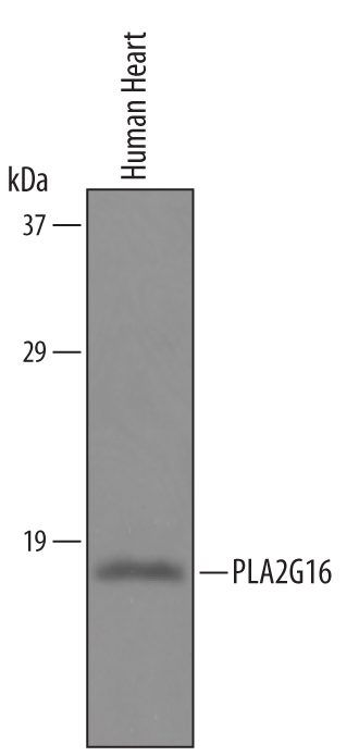 Western blot shows lysates of human heart tissue. PVDF Membrane was probed with 1 µg/mL of Sheep Anti-Human PLA2G16 Antigen Affinity-purified Polyclonal Antibody (Catalog # AF6190) followed by HRP-conjugated Anti-Sheep IgG Secondary Antibody (Catalog # HAF016). A specific band was detected for PLA2G16 at approximately XXX kDa (as indicated). This experiment was conducted under reducing conditions and using Immunoblot Buffer Group XXX.