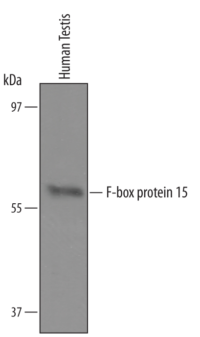 Western blot shows lysates of human testis tissue. PVDF Membrane was probed with 1 µg/mL of Sheep Anti-Human F‑box protein 15/FBXO15 Antigen Affinity-purified Polyclonal Antibody (Catalog # AF6035) followed by HRP-conjugated Anti-Sheep IgG Secondary Antibody (Catalog # HAF016). A specific band was detected for F‑box protein 15/FBXO15 at approximately XXX kDa (as indicated). This experiment was conducted under reducing conditions and using Immunoblot Buffer Group XXX.