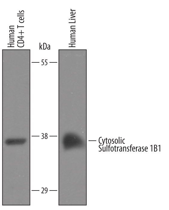 Western blot shows lysates of human CD4+ T Cells and human liver tissue. PVDF Membrane was probed with 1 µg/mL of Sheep Anti-Human Cytosolic Sulfotransferase 1B1/SULT1B1 Antigen Affinity-purified Polyclonal Antibody (Catalog # AF5959) followed by HRP-conjugated Anti-Sheep IgG Secondary Antibody (Catalog # HAF016). A specific band was detected for Cytosolic Sulfotransferase 1B1/SULT1B1 at approximately XXX kDa (as indicated). This experiment was conducted under reducing conditions and using Immunoblot Buffer Group XXX.