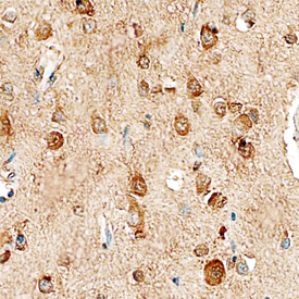 GKAP was detected in immersion fixed paraffin-embedded sections of human brain (cortex) using Mouse Anti-Human GKAP Monoclonal Antibody (Catalog # MAB7296) at 15 µg/mL overnight at 4 °C. Before incubation with the primary antibody, tissue was subjected to heat-induced epitope retrieval using Antigen Retrieval Reagent-Basic (Catalog # CTS013). Tissue was stained using the Anti-Mouse HRP-DAB Cell & Tissue Staining Kit (brown; Catalog # CTS002) and counterstained with hematoxylin (blue). Specific staining was localized to the cytoplasm of neurons. View our protocol for Chromogenic IHC Staining of Paraffin-embedded Tissue Sections.