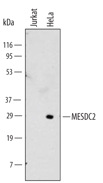 Western blot shows lysates of Jurkat human acute T cell leukemia cell line and HeLa human cervical epithelial carcinoma cell line. PVDF Membrane was probed with 2 µg/mL of Human MESDC2 Monoclonal Antibody (Catalog # MAB5577) followed by HRP-conjugated Anti-Mouse IgG Secondary Antibody (Catalog # HAF007). A specific band was detected for MESDC2 at approximately 29 kDa (as indicated). This experiment was conducted under reducing conditions and using Immunoblot Buffer Group 1.