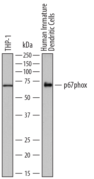 Western blot shows lysates of THP‑1 human acute monocytic leukemia cell line and human immature dendritic cells. PVDF membrane was probed with 0.5 µg/mL of Sheep Anti-Human p67phox Antigen Affinity-purified Polyclonal Antibody (Catalog # AF7830) followed by HRP-conjugated Anti-Sheep IgG Secondary Antibody (Catalog # HAF016). A specific band was detected for p67phox at approximately 70 kDa (as indicated). This experiment was conducted under reducing conditions and using Immunoblot Buffer Group 1.