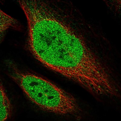 Immunocytochemistry/Immunofluorescence: CTDSPL2 Antibody [NBP1-91814] - Immunofluorescent staining of human cell line U-2 OS shows localization to nucleoplasm.