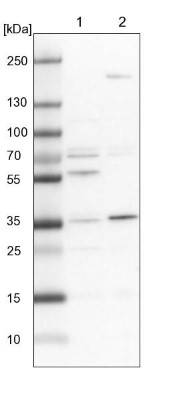 Western Blot: C19orf47 Antibody [NBP1-91722] - Lane 1: NIH-3T3 cell lysate (Mouse embryonic fibroblast cells). Lane 2: NBT-II cell lysate (Rat Wistar bladder tumor cells).