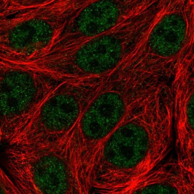 Immunocytochemistry/Immunofluorescence: C19orf47 Antibody [NBP1-91722] - Immunofluorescent staining of human cell line MCF7 shows localization to nucleoplasm.