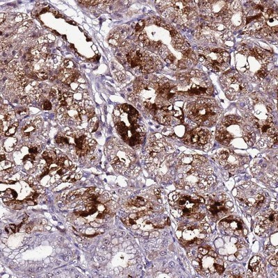 Immunohistochemistry-Paraffin: C19orf47 Antibody [NBP1-91722] - Staining of human stomach, lower shows strong cytoplasmic positivity in glandular cells.