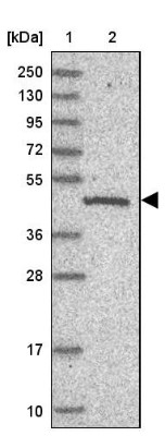 Western Blot: C19orf47 Antibody [NBP1-91722] - Lane 1: Marker  [kDa] 250, 130, 95, 72, 55, 36, 28, 17, 10.  Lane 2: Human cell line RT-4