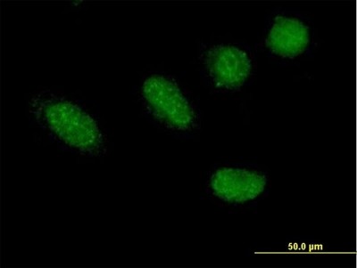 Immunocytochemistry/Immunofluorescence: GRHL2 Antibody [H00079977-B01P] - Analysis of purified antibody to GRHL2 on HeLa cell. (antibody concentration 10 ug/ml)
