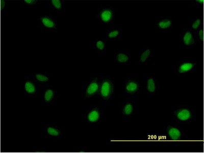 Immunocytochemistry/Immunofluorescence: MED21 Antibody (3E9) [H00009412-M08] - Analysis of monoclonal antibody to SURB7 on HeLa cell. Antibody concentration 10 ug/ml