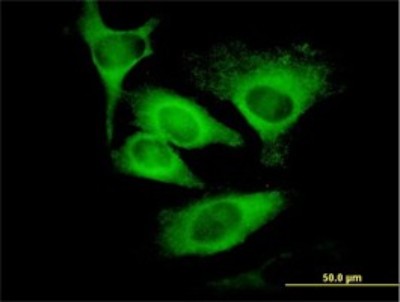 Immunocytochemistry/Immunofluorescence: EIF5 Antibody (2E6-4C12) [H00001983-M01] - Analysis of monoclonal antibody to EIF5 on HeLa cell. Antibody concentration 10 ug/ml.