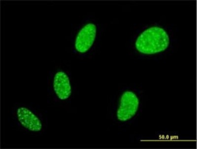 Immunocytochemistry/Immunofluorescence: BCL7B Antibody (6D2) [H00009275-M01] - Analysis of monoclonal antibody to BCL7B on HeLa cell. Antibody concentration 10 ug/ml.