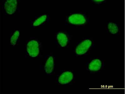 Immunocytochemistry/Immunofluorescence: TH1L Antibody [H00051497-B01P] - Analysis of purified antibody to TH1L on HeLa cell. (antibody concentration 10 ug/ml)