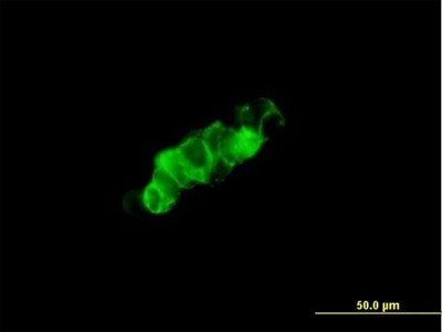 Immunocytochemistry/Immunofluorescence: GPRC5C Antibody [H00055890-B01P] - Analysis of purified antibody to GPRC5C on 293 cell. (antibody concentration 1 ug/ml)