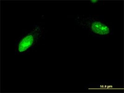 Immunocytochemistry/Immunofluorescence: ZNF397 Antibody (1F8) [H00084307-M02] - Analysis of monoclonal antibody to ZNF397 on HeLa cell. Antibody concentration 10 ug/ml.