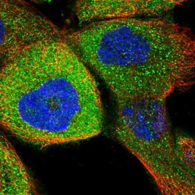 Immunocytochemistry/Immunofluorescence: RUSC1 Antibody [NBP1-81005] - Staining of human cell line A-431 shows positivity in cytoplasm.