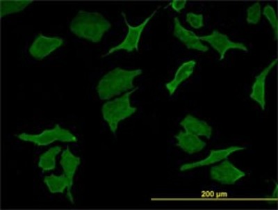 Immunocytochemistry/Immunofluorescence: DPYD Antibody (7D4) [H00001806-M01] - Analysis of monoclonal antibody to DPYD on HeLa cell. Antibody concentration 10 ug/ml.